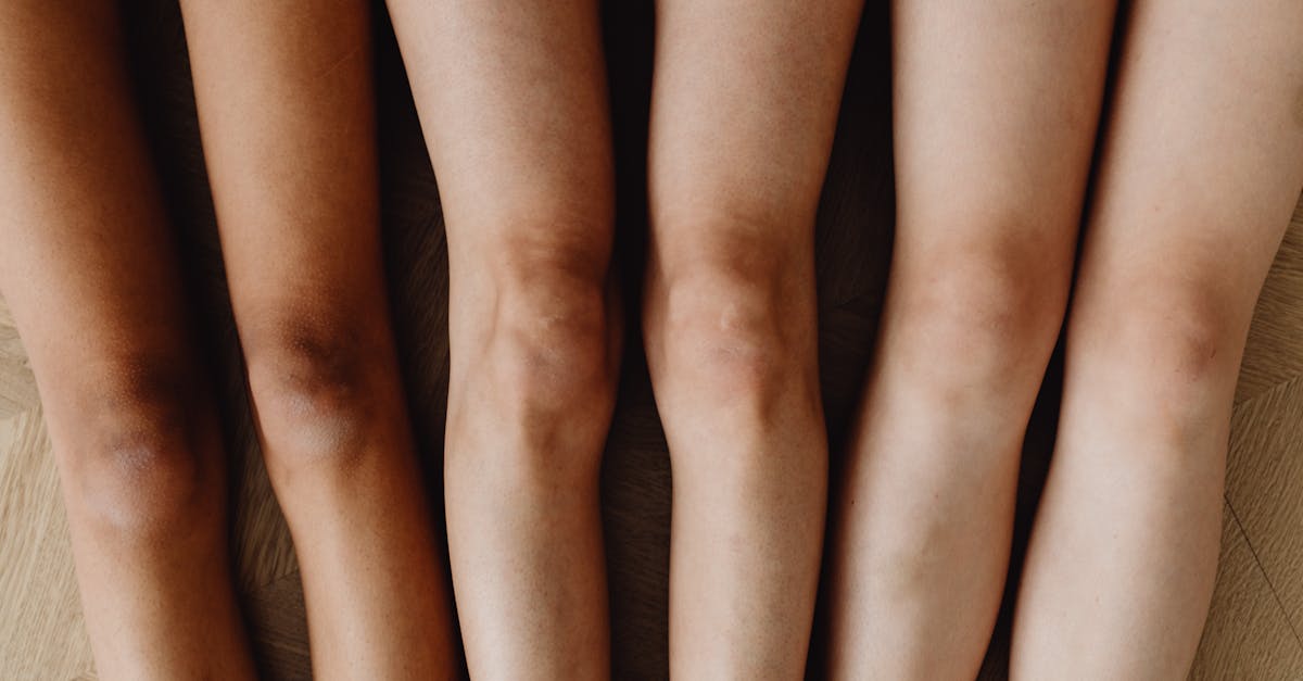 Effective Stretching Exercises for Post-Knee Surgery Recovery