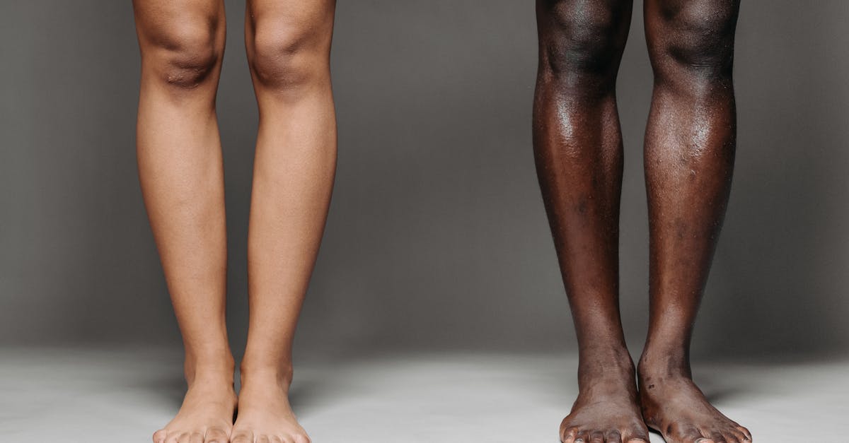 Evaluating Symptom Patterns in Knee Pain: A Clinician's Approach