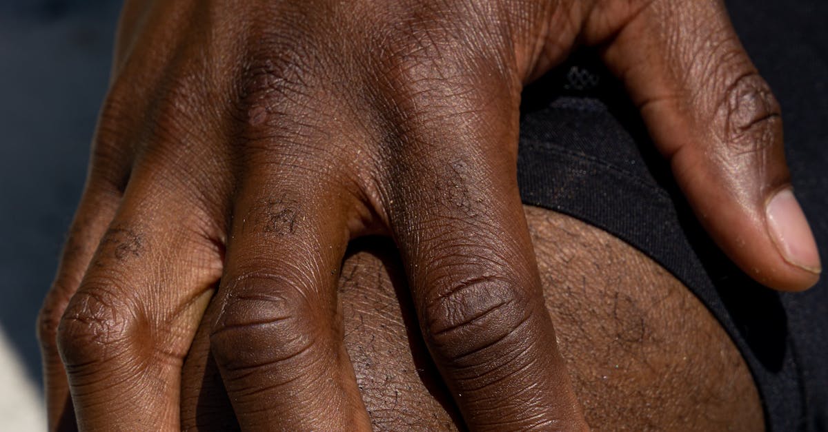 Identifying Common Knee Injuries through Physical Examination
