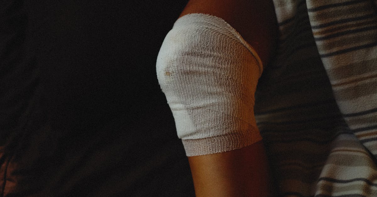 The Importance of Capturing Previous Injuries in Knee Assessments