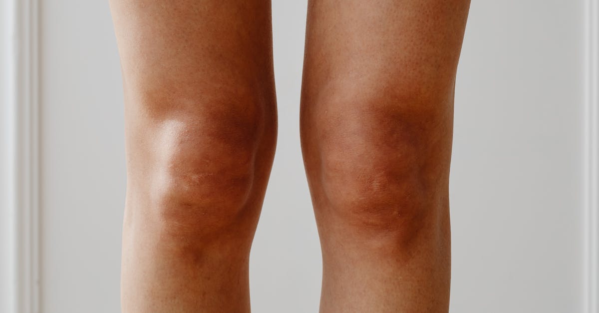 Utilising Kinesiology Taping for Knee Pain Relief